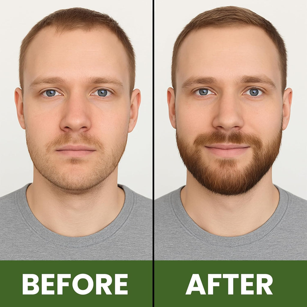 100% Pure Natural Undiluted Eucalyptus Essential Oil (4Oz) Premium Therapeutic Grade Aromatherapy