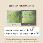 Wonder Black Rice Hyaluronic Toner, Deep Hydration, Glass Skin, Hyaluronic Acid, Lavender Oil, Skin Plumpling, Korean Skincare, Vegan, Cruelty-Free, 10.1 Fl.Oz